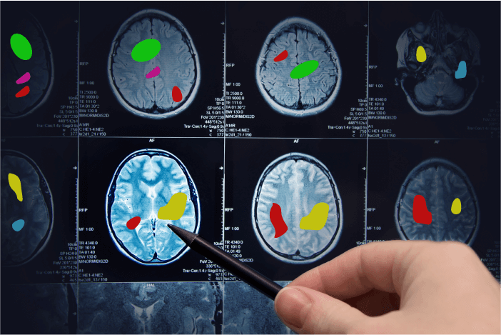 Medical Imaging