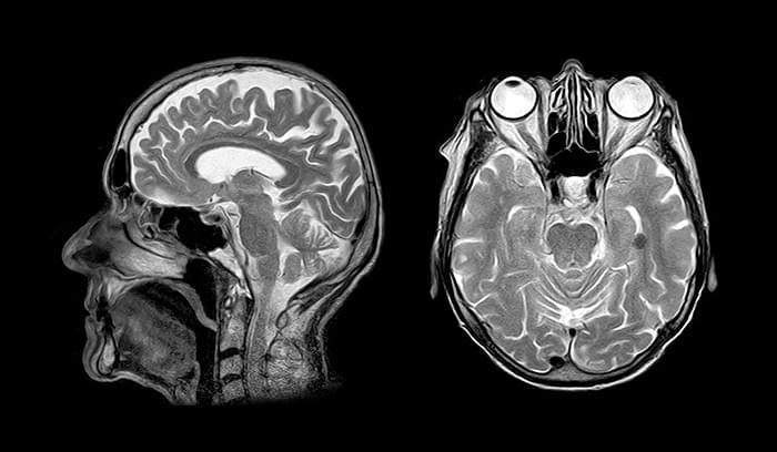 DICOM Processing