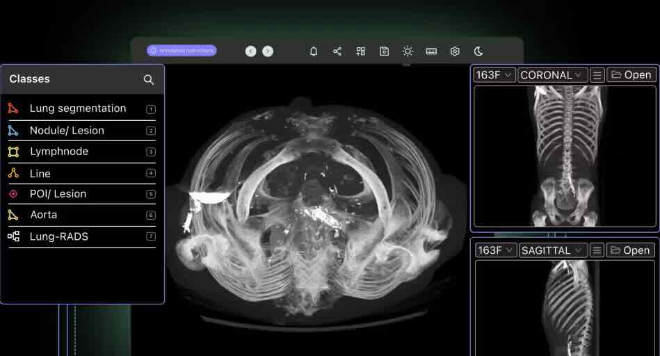 Radiology Images