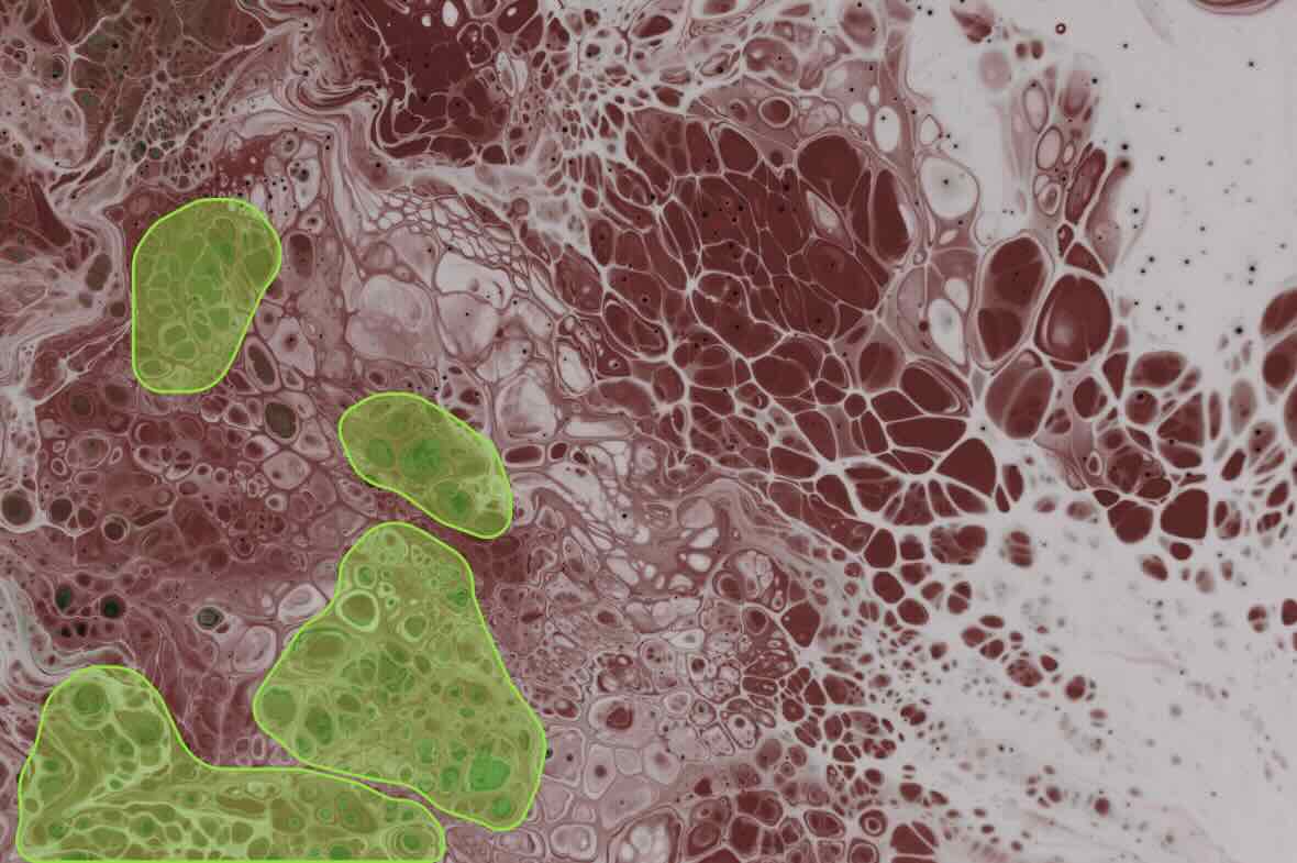 Pathology Slides